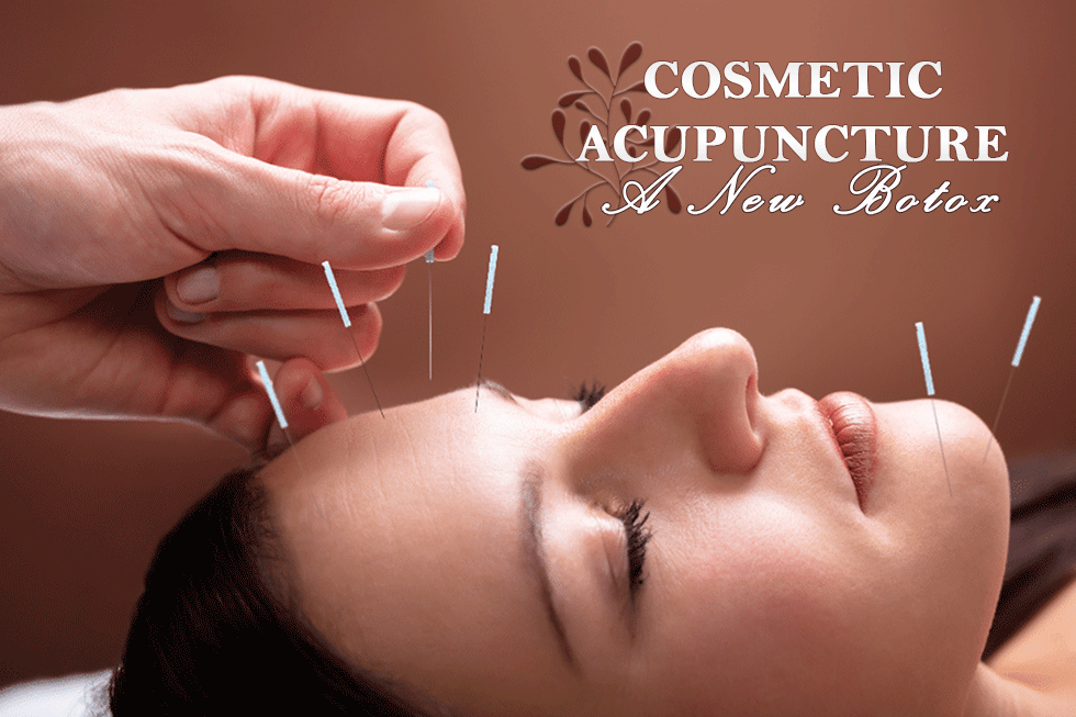 Facial Cosmetic Acupuncture: Benefits and How It Works : It is considered a natural botox