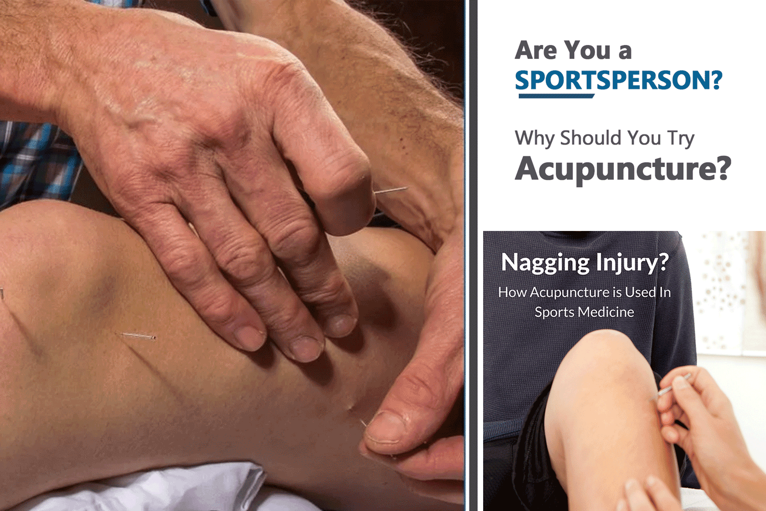 Acupuncture in Sports Medicine. Acupuncture is gaining popularity and wider acceptance as a treatment modality within the field of sports medicine. 